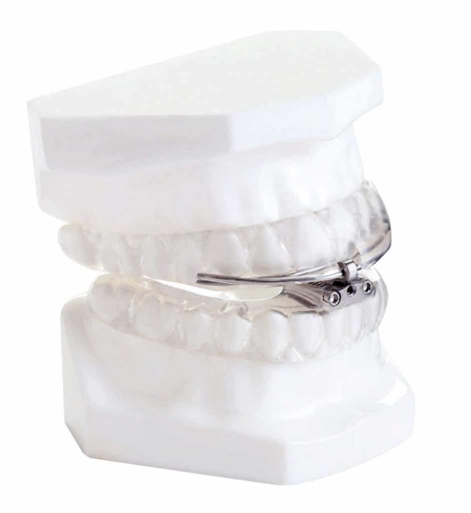 snoring mouth guard