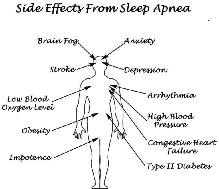 Sleep Apnea and Anxiety Are Sleep Apnea And Anxiety Disorder Related